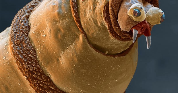 22 fotografi mahnitëse elektro mikroskopike